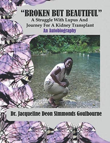 BROKEN BUT BEAUTIFUL A STRUGGLE WITH LUPUS AND JOURNEY FOR KIDNEY TRANSPLANT A AUTOBIOGRAPHY